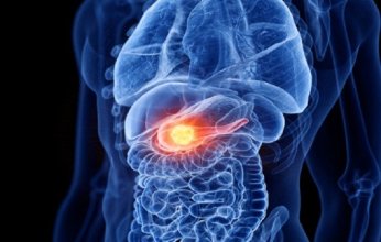 دراسة حديثة تحذر: التدخين يزيد خطر الإصابة بسرطان البنكرياس