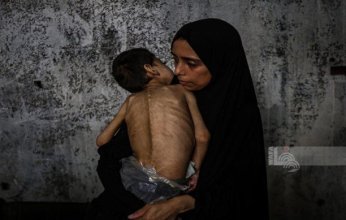 5 وفيات من بينها 3 أطفال نتيجة المجاعة وسوء التغذية خلال الـ24 ساعة الماضية