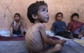 صحة غزة: 453 وفاة بسبب المجاعة وسوء التغذية بينها 150 طفلا
