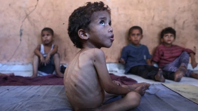 صحة غزة: 453 وفاة بسبب المجاعة وسوء التغذية بينها 150 طفلا صحة غزة: 453 وفاة بسبب المجاعة وسوء التغذية بينها 150 طفلا