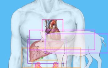 الصين تسجل سابقة طبية عالمية بزراعة كبد خنزير معدل وراثيا لمريض حي