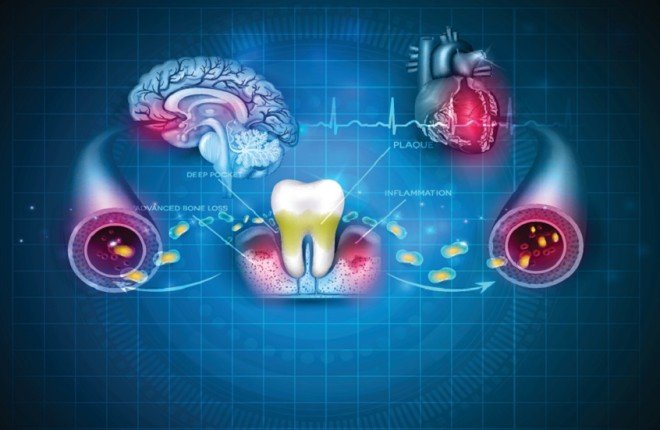 دراستان تكشفان.. تدهور صحة الفم قد يؤدي إلى تلف الدماغ وأمراض القلب دراستان تكشفان.. تدهور صحة الفم قد يؤدي إلى تلف الدماغ وأمراض القلب