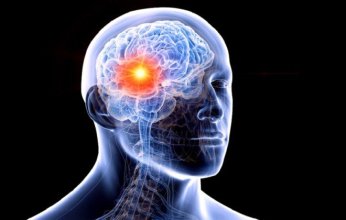 أعراض يومية شائعة قد تنذر مبكرًا بأورام في الدماغ.. تعرف عليها