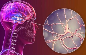 علماء يطورون نظام ذكاء اصطناعي يشخص نوعا من ورم الدماغ