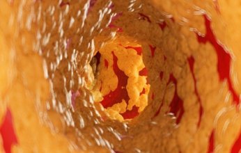 دراسة حديثة: دهون خفية حول الأعضاء تهدد الشرايين حتى لدى النحفاء