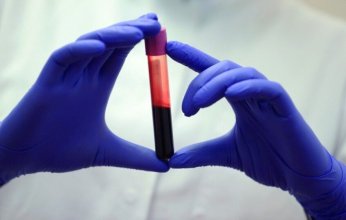 فحص دم ثوري يكشف 50 نوعاً من السرطان قبل ظهور الأعراض