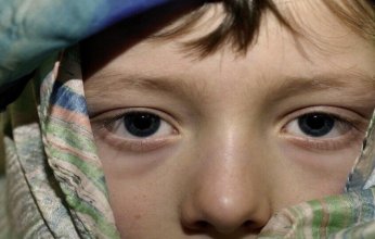 ليست مجرد قلة نوم.. ألوان الهالات تحت العينين تكشف عن مشكلات صحية داخلية