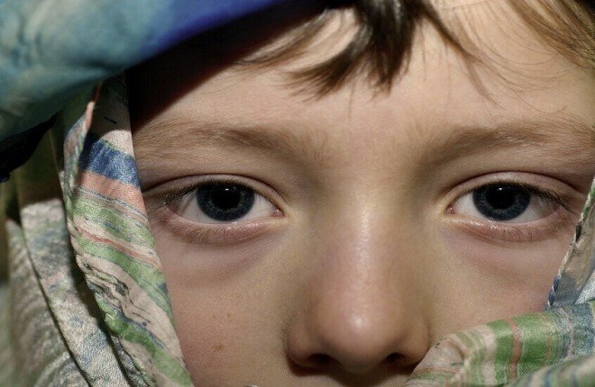 ليست مجرد قلة نوم.. ألوان الهالات تحت العينين تكشف عن مشكلات صحية داخلية ليست مجرد قلة نوم.. ألوان الهالات تحت العينين تكشف عن مشكلات صحية داخلية