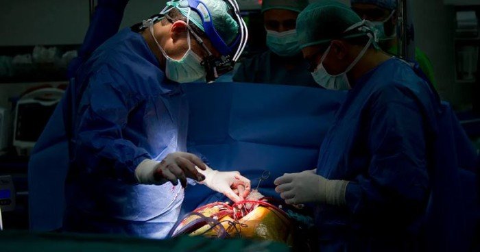 مصر.. استخراج هاتف من بطن مريض بعد 11 شهرًا من ابتلاعه