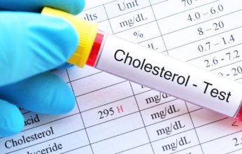 علاج للكوليسترول من «أمجين» يقلل خطر أمراض القلب والأوعية 25%