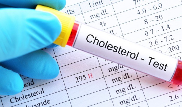 علاج للكوليسترول من «أمجين» يقلل خطر أمراض القلب والأوعية 25% علاج للكوليسترول من «أمجين» يقلل خطر أمراض القلب والأوعية 25%