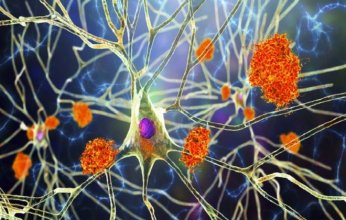 "النبات المعجزة".. اكتشاف مركبات واعدة في الصبّار قد تمهّد لعلاج ألزهايمر