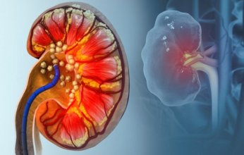 "بول الثعابين" قد يمهّد لتقنيات جديدة لعلاج النقرس وحصوات الكلى