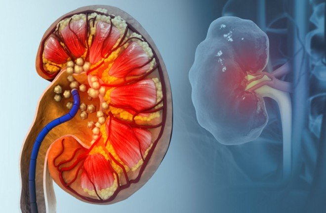 "بول الثعابين" قد يمهّد لتقنيات جديدة لعلاج النقرس وحصوات الكلى