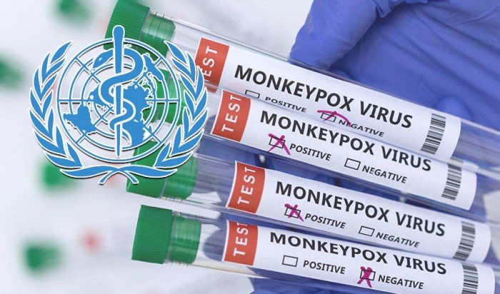 «الصحة العالمية»: تسجيل إصابات جديدة بجدري القردة وظهور السلالة «آي.بي» في دول جديدة «الصحة العالمية»: تسجيل إصابات جديدة بجدري القردة وظهور السلالة «آي.بي» في دول جديدة