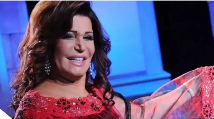 أخر تطورات الحالة الصحية لـ نجوى فؤاد بعد جراحة الظهر