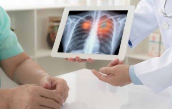 باحثون: اكتشاف المحرك الرئيسي لتطور سرطان الرئة في مراحله المبكرة