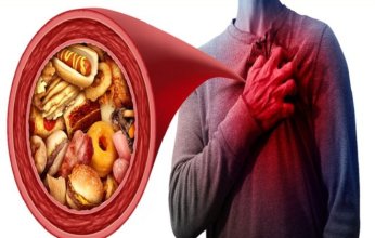 نتائج مفاجئة تعيد تقييم دور الدهون المشبعة في صحة القلب.. ما التفاصيل؟