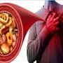 نتائج مفاجئة تعيد تقييم دور الدهون المشبعة في صحة القلب.. ما التفاصيل؟ 7 khaligyoun63590