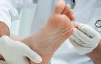 يجب مراقبتها.. علامة تحذيرية بالقدم تشير لنقص فيتامين ب12
