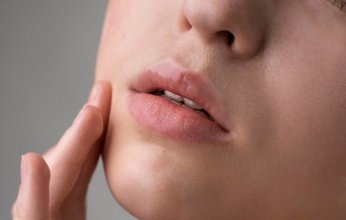 طرق طبيعية لتقشير الشفاه والحفاظ على ترطيبها