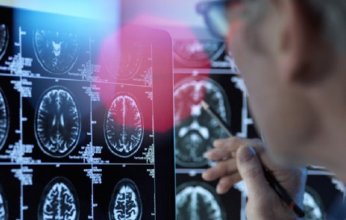 إعادة توظيف أدوية معروفة تفتح آفاقاً جديدة في مكافحة ألزهايمر