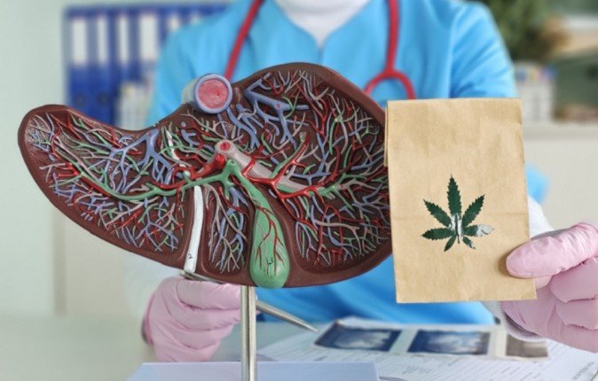 القنب قد يكون مفتاحا لعلاج مرض الكبد الدهني القنب قد يكون مفتاحا لعلاج مرض الكبد الدهني