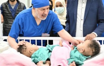 بدء عملية فصل التوأم الملتصق الصومالي “رحمة ورملا” في الرياض