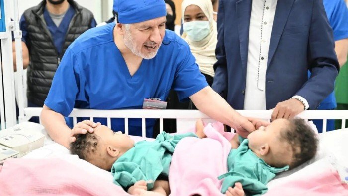 بدء عملية فصل التوأم الملتصق الصومالي “رحمة ورملا” في الرياض بدء عملية فصل التوأم الملتصق الصومالي “رحمة ورملا” في الرياض