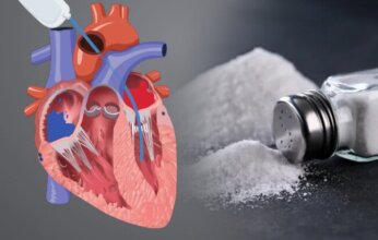 دراسة.. الإفراط في تناول الصوديوم يزيد خطر الإصابة بقصور القلب