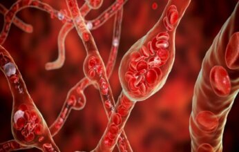 دراسة حديثة تكشف سببًا محتملًا جديدًا لارتفاع ضغط الدم وفتح آفاق لعلاجات مبتكرة