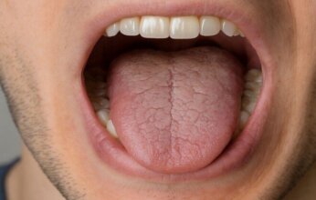 أمراض خطيرة قد يخبئها جفاف الفم.. من السكري إلى اضطرابات المناعة