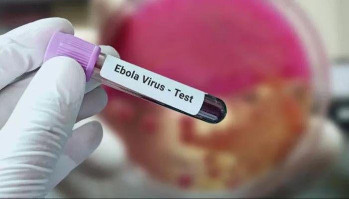 لقاح تجريبي جديد ضد «إيبولا».. خطوة بريطانية تبعث الأمل في أفريقيا لقاح تجريبي جديد ضد «إيبولا».. خطوة بريطانية تبعث الأمل في أفريقيا
