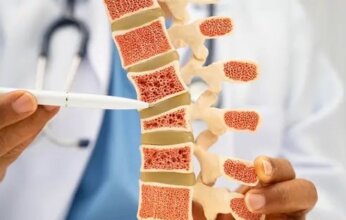 حالة صامتة تهدد 40% من البالغين: هشاشة العظام الخفيفة إنذار مبكر لمخاطر أكبر