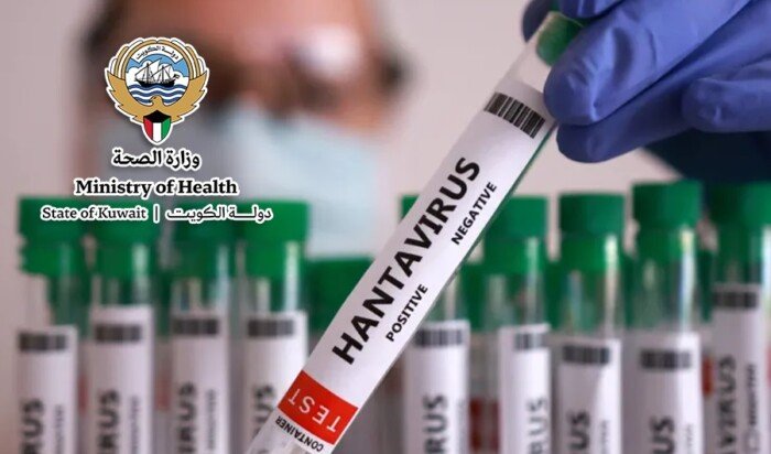 الصحة الكويتية: نتابع مستجدات «فيروس هانتا».. ومستوى الخطر في البلاد منخفض الصحة الكويتية: نتابع مستجدات «فيروس هانتا».. ومستوى الخطر في البلاد منخفض
