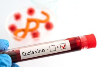 خبراء يحددون لقاحات وعلاجات مرشحة لسلالة «بونديبوجيو» من الإيبولا