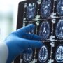 لعبة ذهنية بسيطة قد تقلل خطر الخرف بنسبة 25% 3 khaligyoun80592