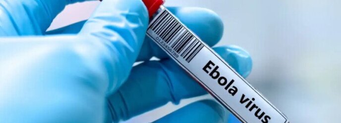 الأمم المتحدة تحذر: تفشي "إيبولا" قد يكبد إفريقيا 3.6 مليار دولار ويهدد مئات الآلاف من الوظائف الأمم المتحدة تحذر: تفشي "إيبولا" قد يكبد إفريقيا 3.6 مليار دولار ويهدد مئات الآلاف من الوظائف