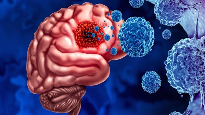 دراسة: إصابات الرأس قد ترفع خطر الوفاة بسرطان الدماغ دراسة: إصابات الرأس قد ترفع خطر الوفاة بسرطان الدماغ