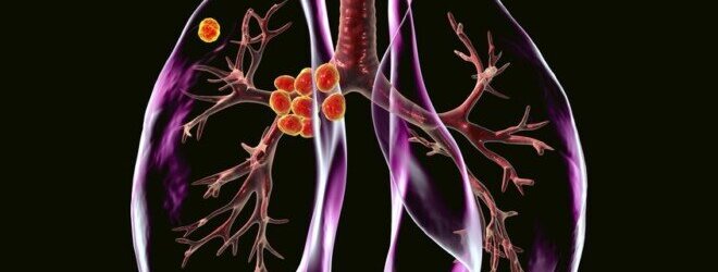 دراسة تكشف آلية جديدة وراء التليف الرئوي وتمهد لعلاجات مستقبلية دراسة تكشف آلية جديدة وراء التليف الرئوي وتمهد لعلاجات مستقبلية